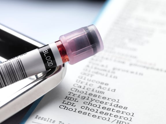 Phlebotomy Services On-Demand