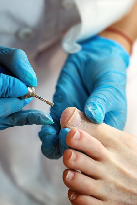 Diabetes Toenail Care On-the-Go