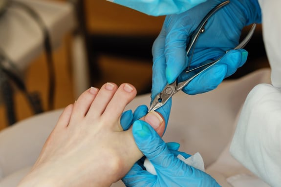 Mobile Diabetic Toenail Trim