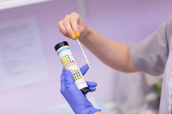 On-the-Go Urinalysis Check