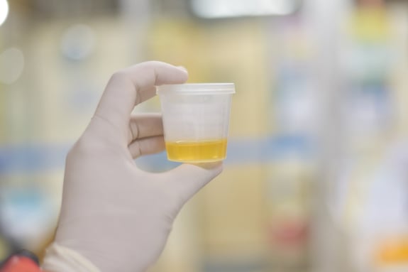 Quick Urine Sample Collection