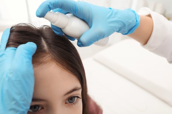 Lice Removal