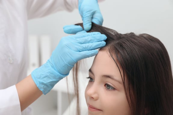 Lice Check